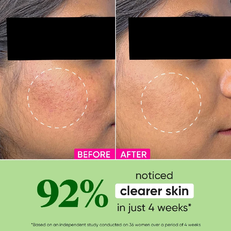 Dot & Key CICA + Niacinamide Oil Free Moisturizer for Acne Prone Skin, 50 g-3.webp